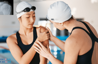 L'image montre une nageuse souffrir d'une Tendinite Calcifiante de l'Épaule