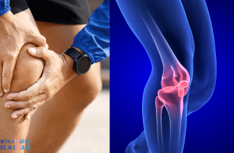 L'image montre une arthrite du genou