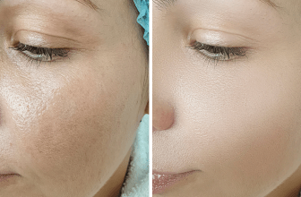 L'image montre un visage d'une femme avant et après un Massage Tonifiant