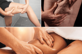 L'image montre plusieurs femmes avec de la cellulite sur les cuisses.