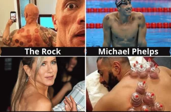 L'image montre certains stars comme TheRock, Michael Phelps, Jennifer Aniston et Karim Benzema pratiquer la Hijama ou le cupping therapie