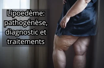 Image montrant une personne atteinte de lipœdème avec une accumulation de graisse sur les jambes. Le texte indique 'Lipoedème: pathogénèse, diagnostic et traitements'.
